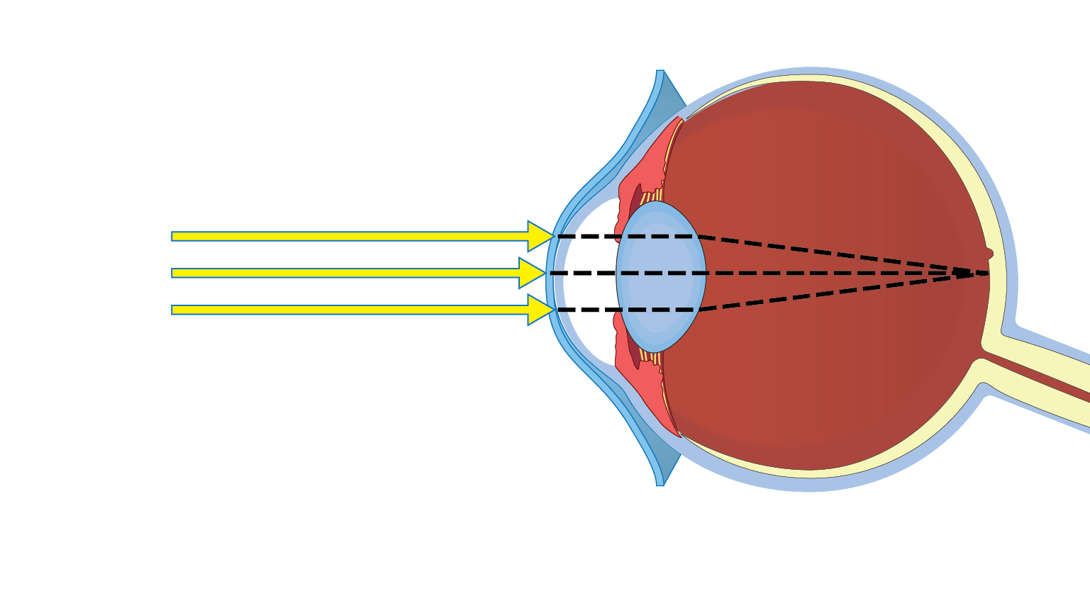 Darwin himself wrote of eyes,